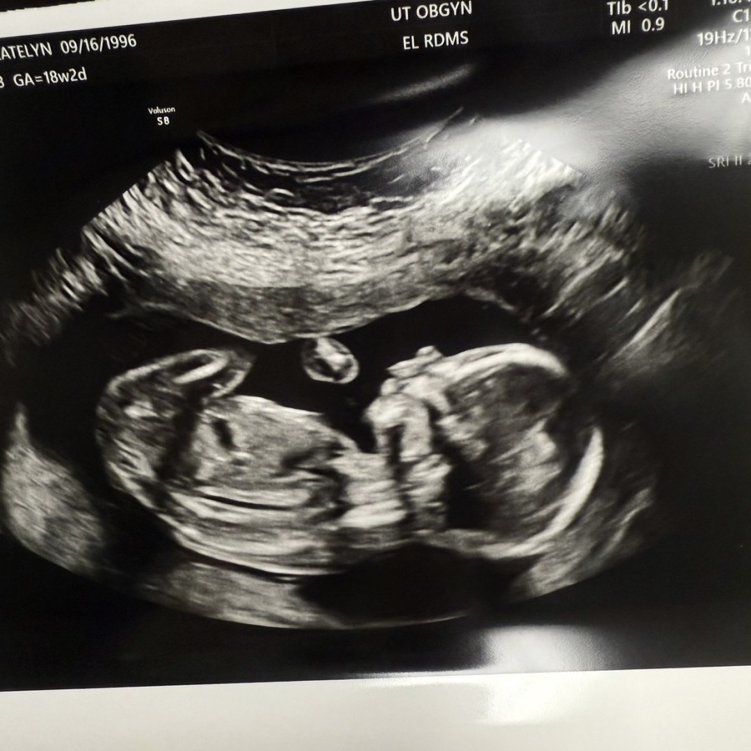 Photo shared by Katelyn for their Babylist baby registry.