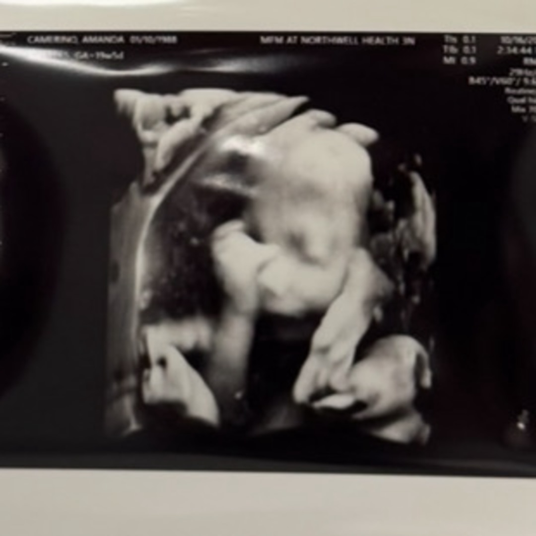 Photo shared by Amanda for their Babylist baby registry.