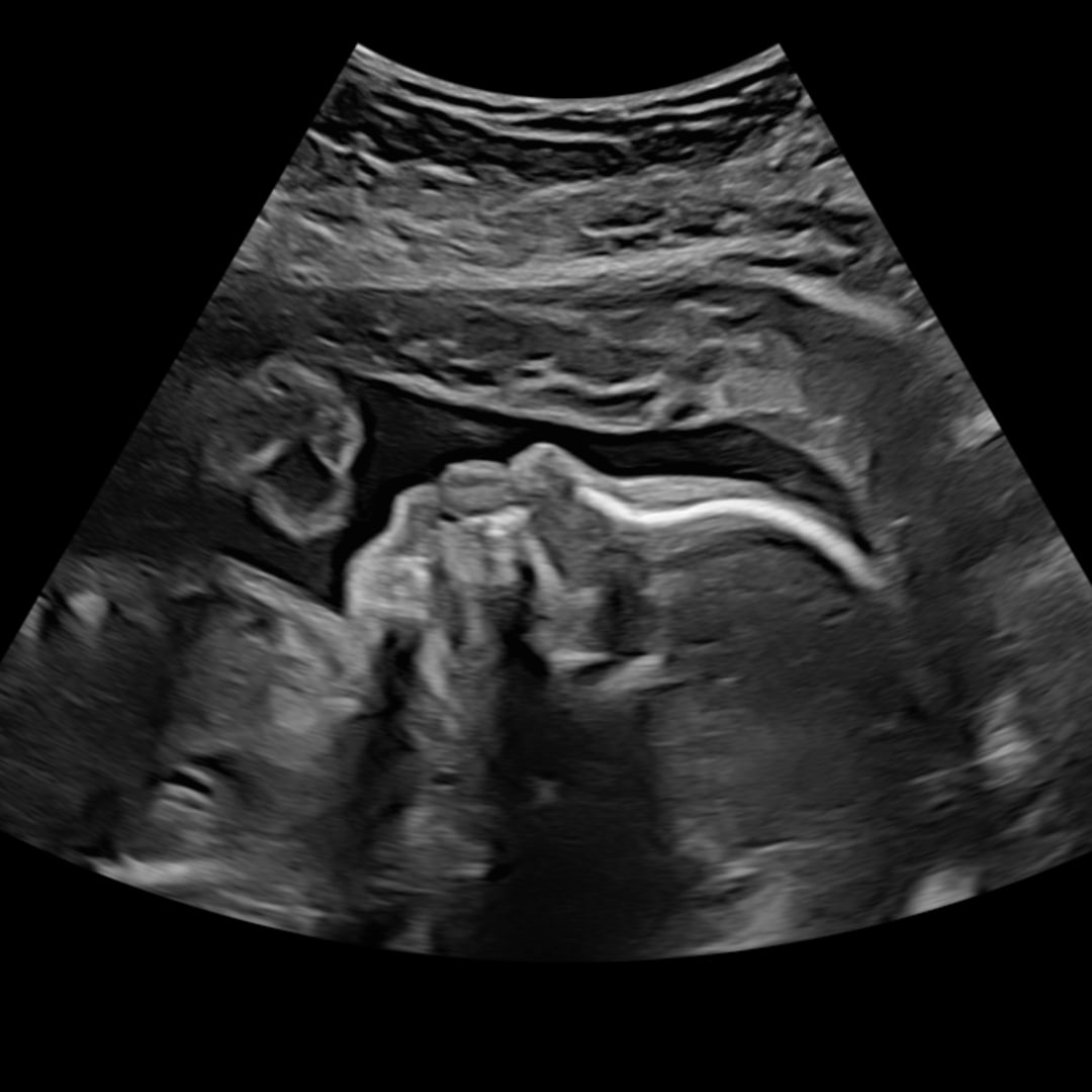 Photo shared by Zyrie for their Babylist baby registry.