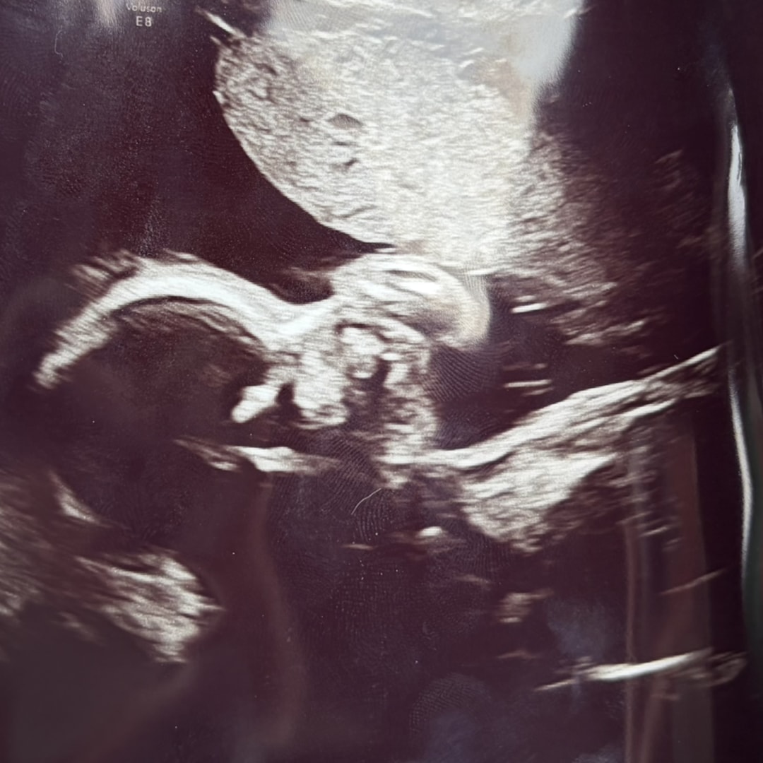Photo shared by Teanna for their Babylist baby registry.