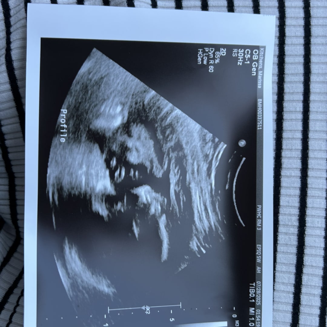 Photo shared by Marissa for their Babylist baby registry.
