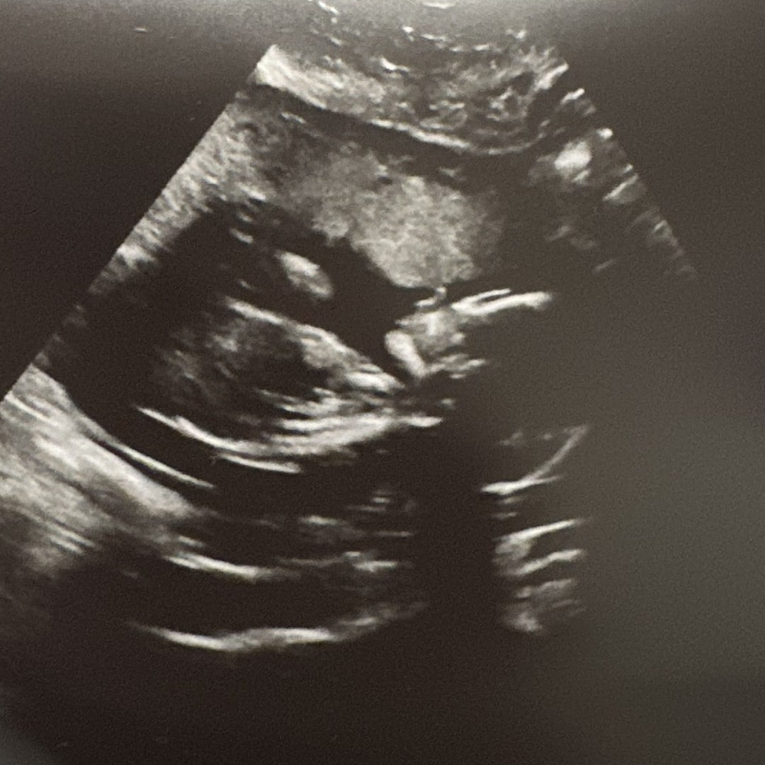 Photo shared by Alyssa for their Babylist baby registry.