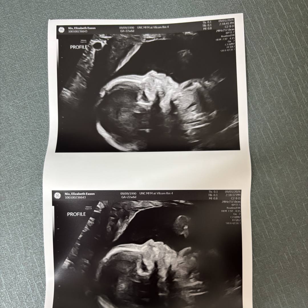 Photo shared by Elizabeth for their Babylist baby registry.