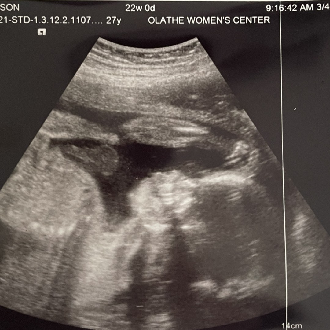 Photo shared by Allie for their Babylist baby registry.