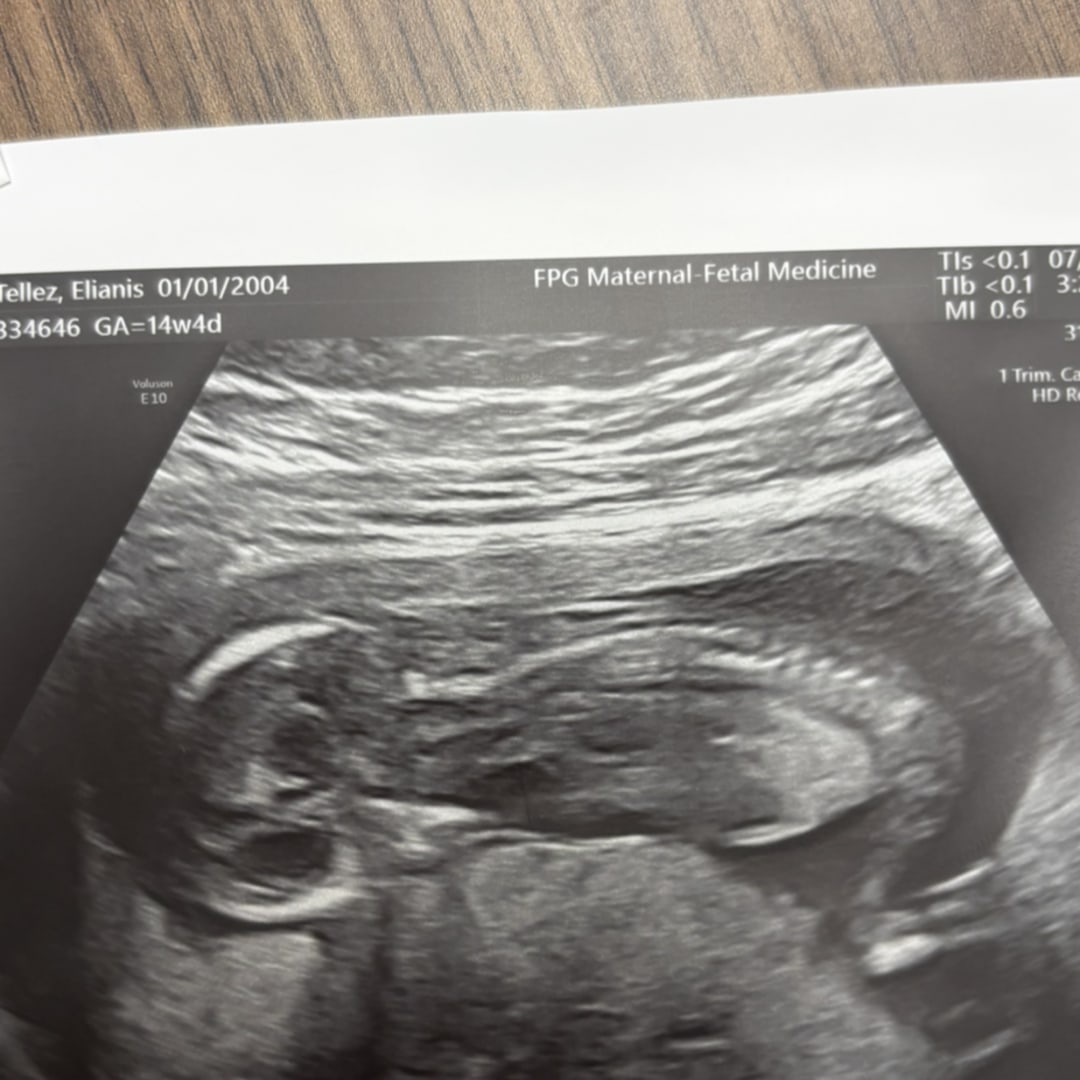 Photo shared by Elianis for their Babylist baby registry.