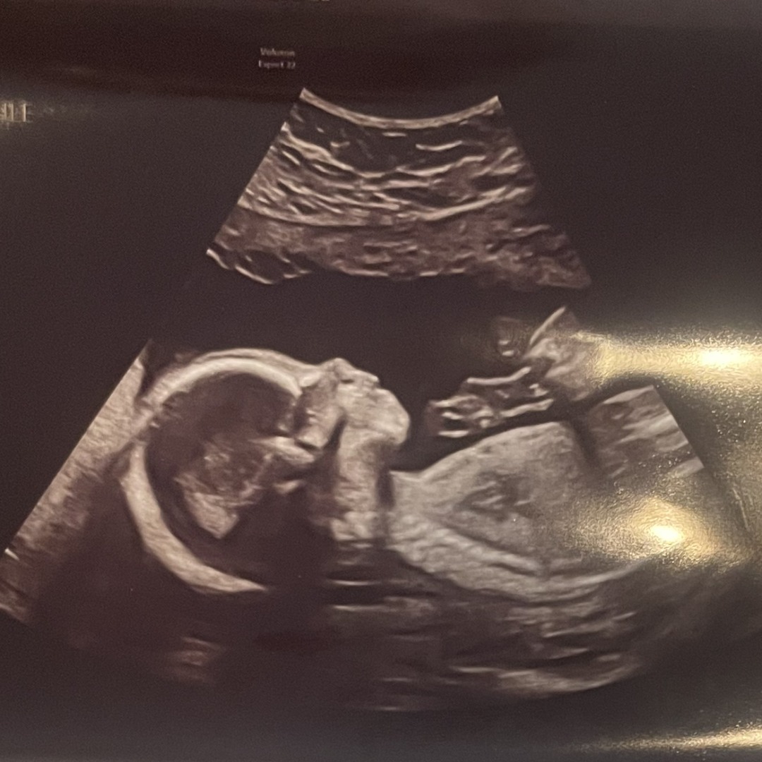 Photo shared by Rosie for their Babylist baby registry.