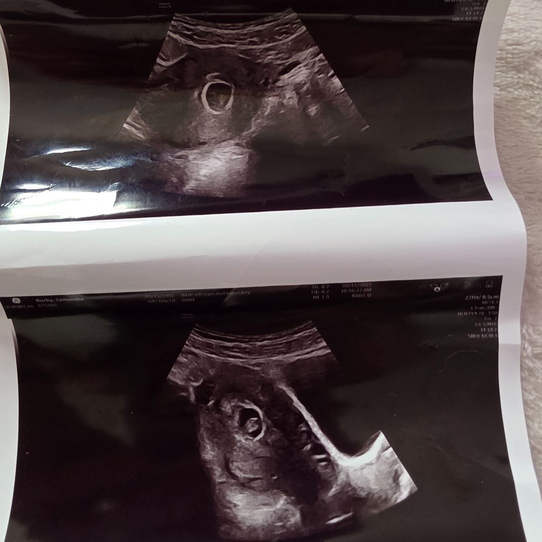 Photo shared by Samantha for their Babylist baby registry.