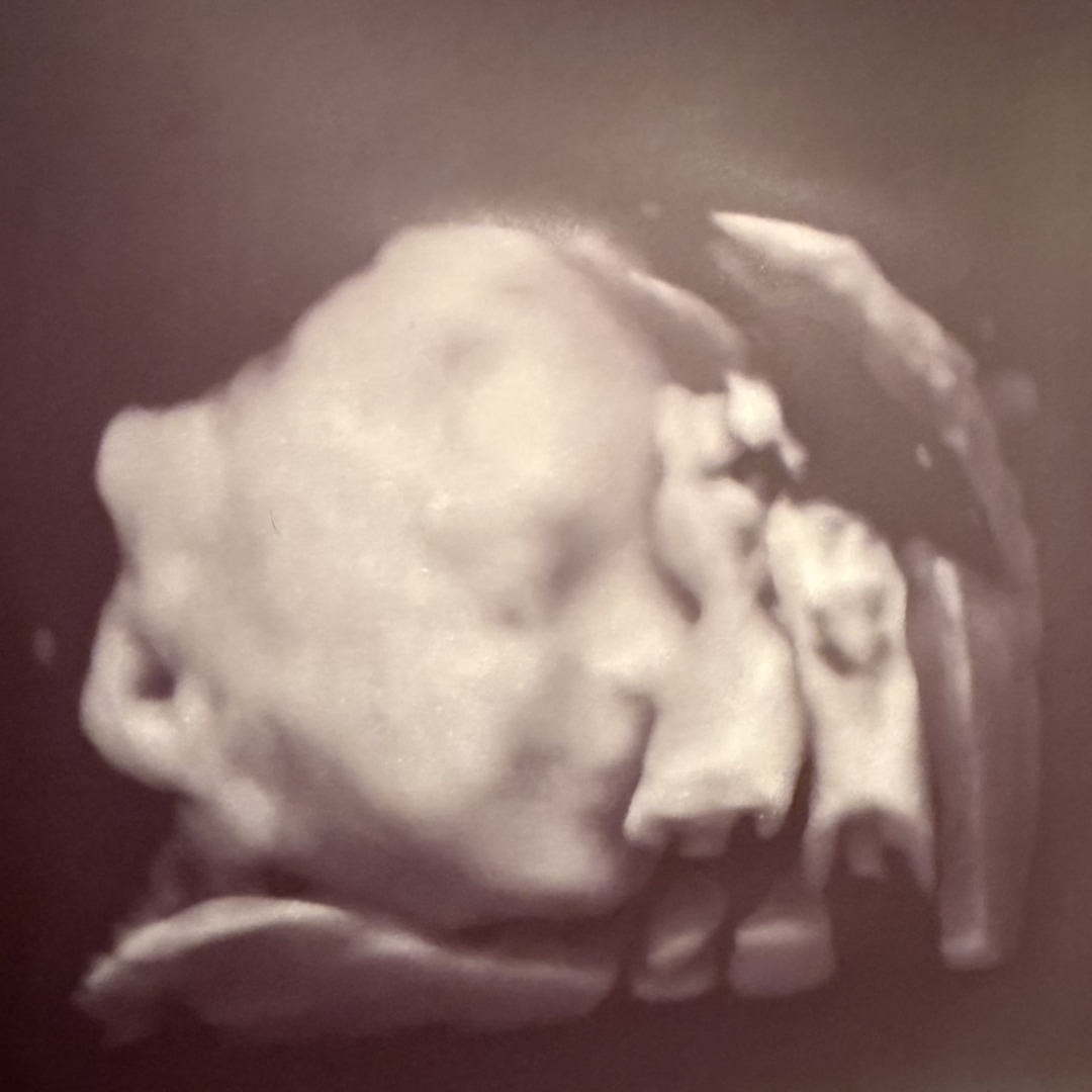 Photo shared by Chelsea for their Babylist baby registry.