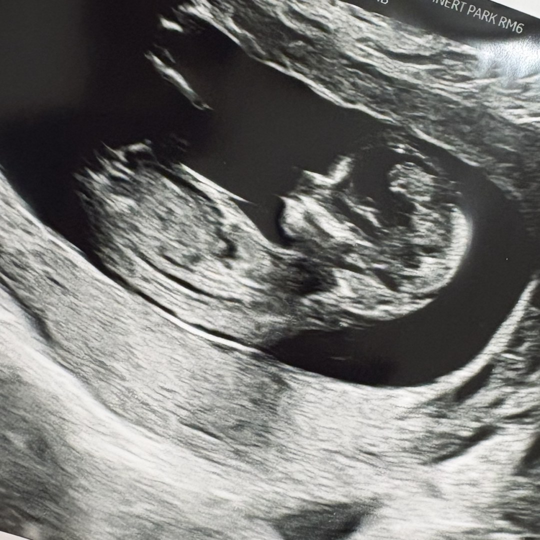 Photo shared by Cece for their Babylist baby registry.