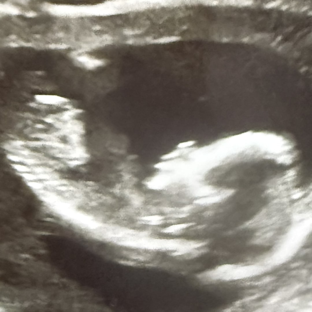 Photo shared by Megan for their Babylist baby registry.