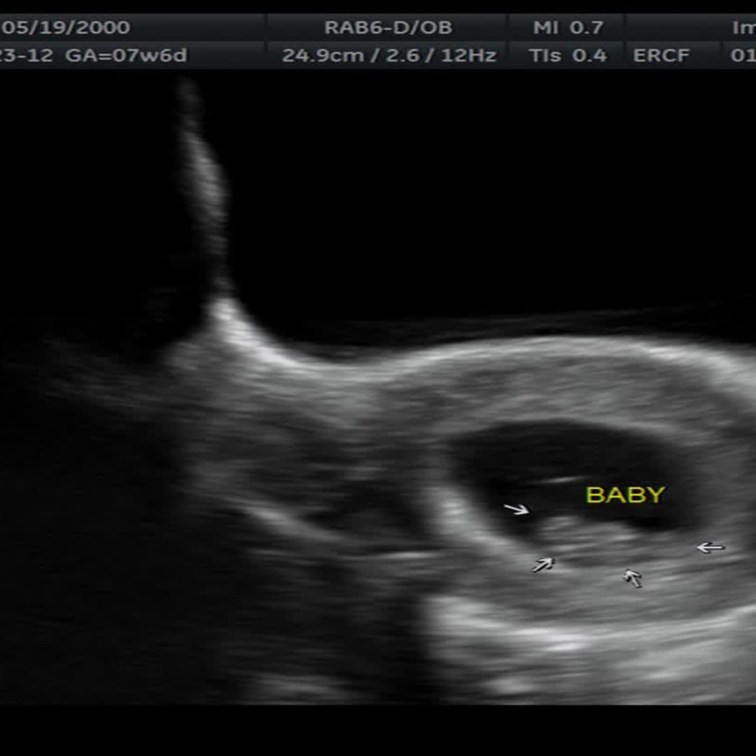 Photo shared by Chloé for their Babylist baby registry.