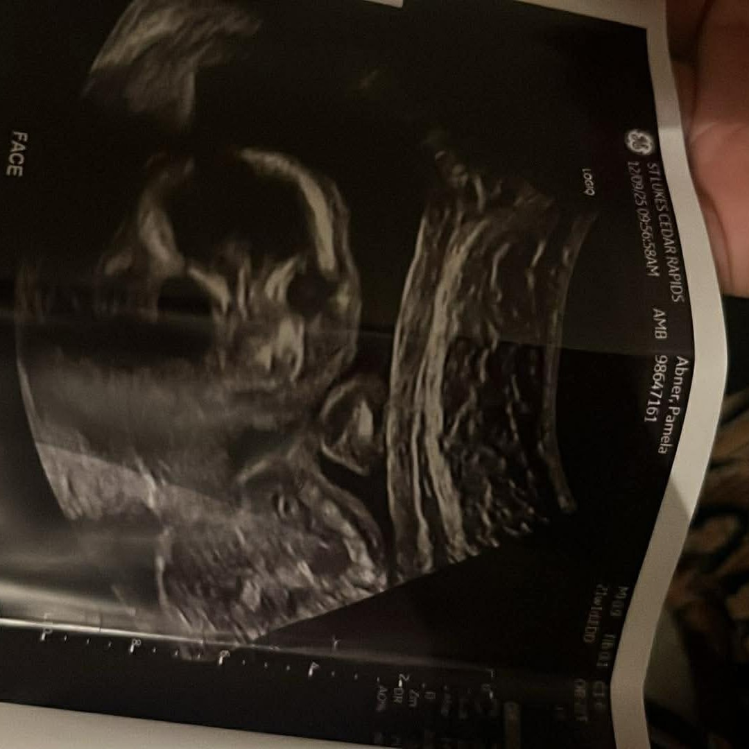 Photo shared by Pamela for their Babylist baby registry.