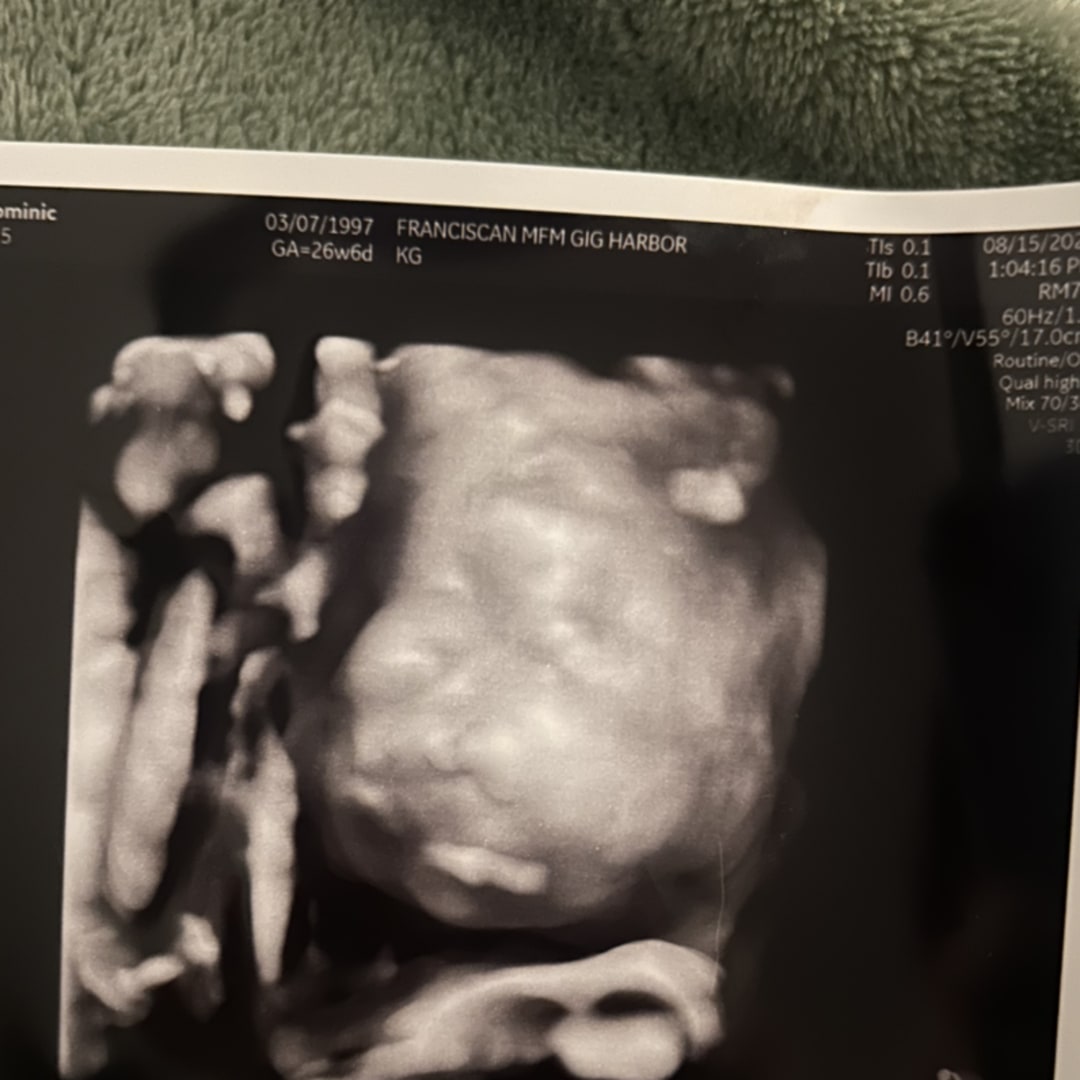 Photo shared by Dominic for their Babylist baby registry.