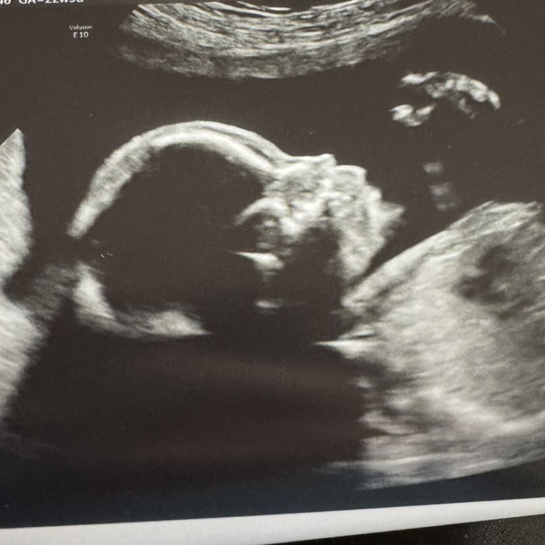 Photo shared by Anika for their Babylist baby registry.
