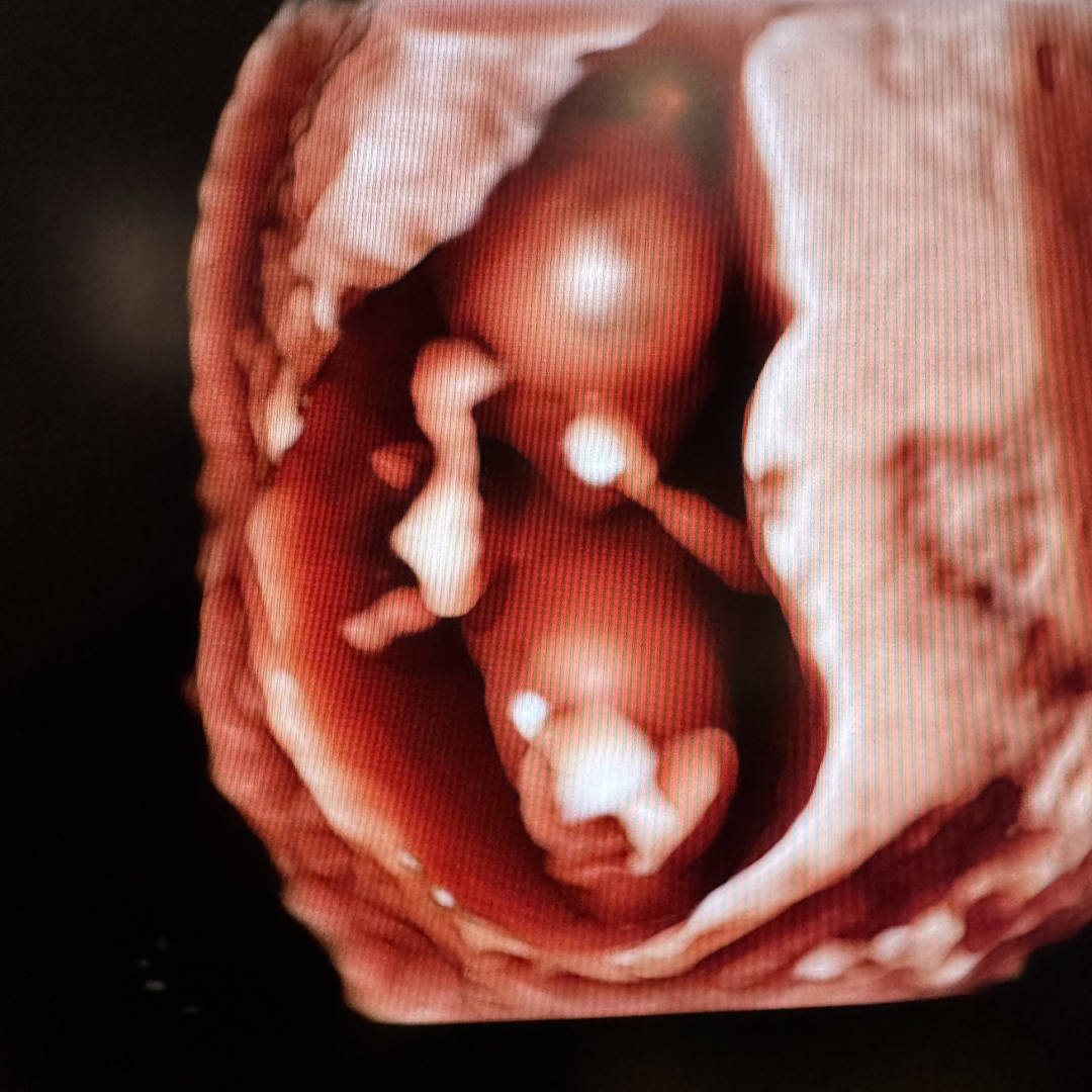 Photo shared by Tara for their Babylist baby registry.