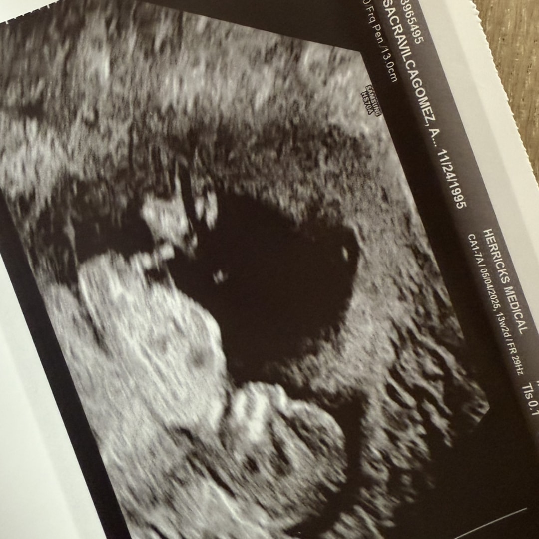 Photo shared by Angel for their Babylist baby registry.