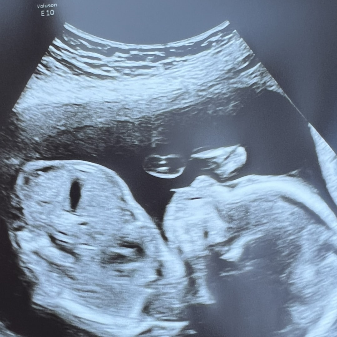 Photo shared by Danielle for their Babylist baby registry.
