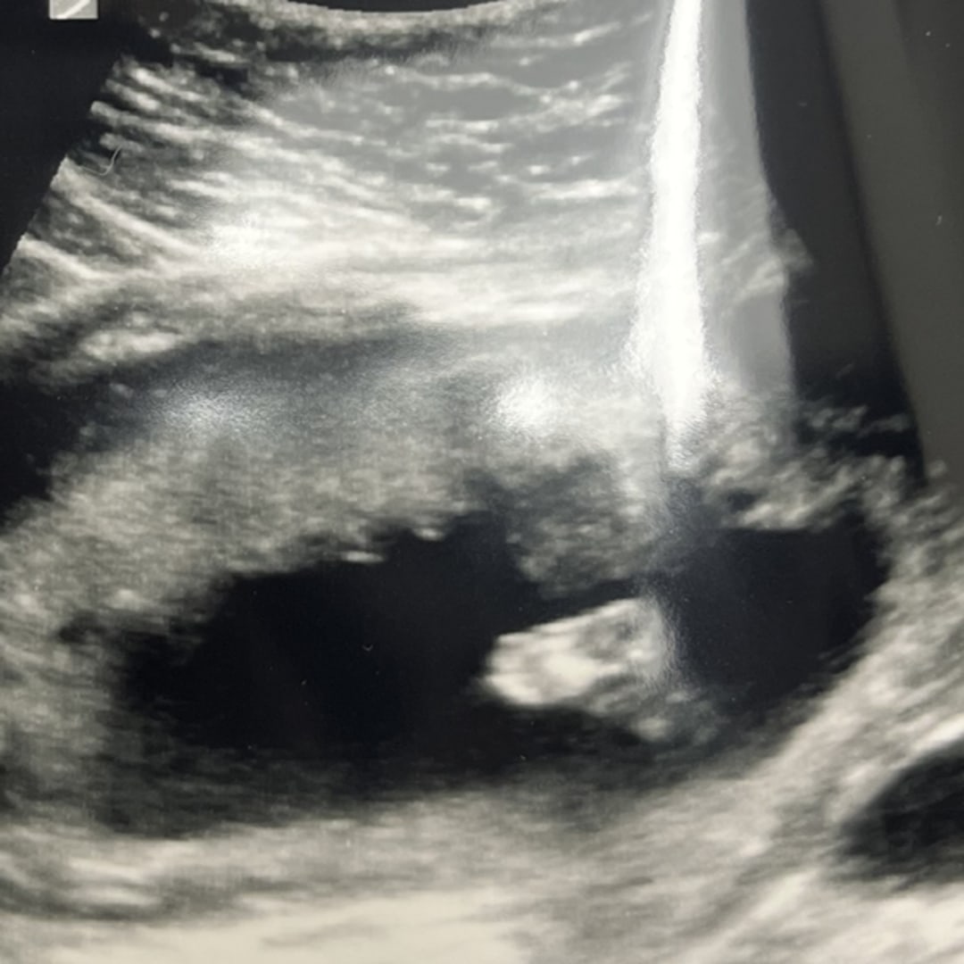 Photo shared by Tiffany for their Babylist baby registry.