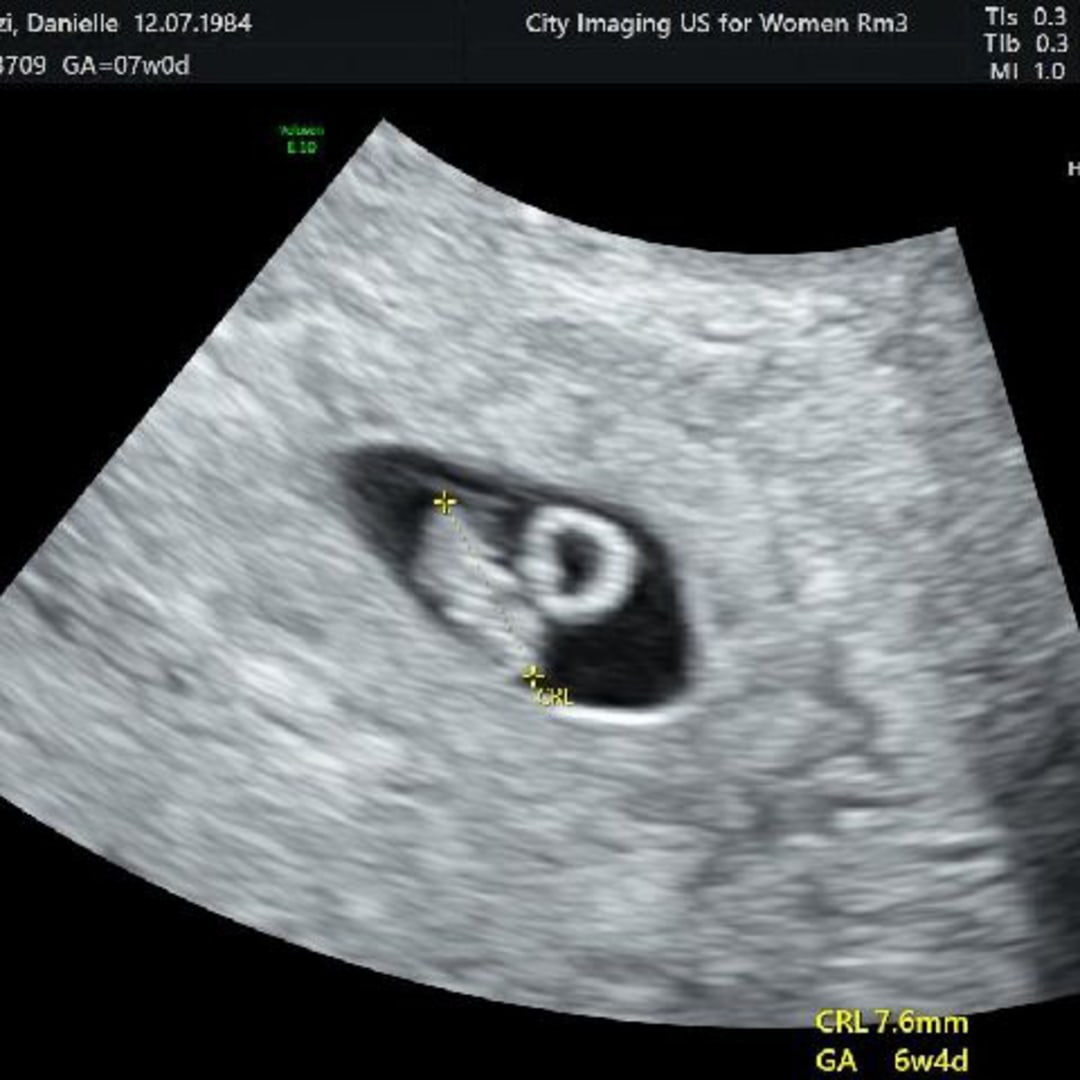 Photo shared by Danielle for their Babylist baby registry.