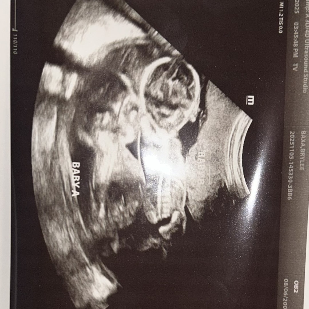 Photo shared by Brylee for their Babylist baby registry.