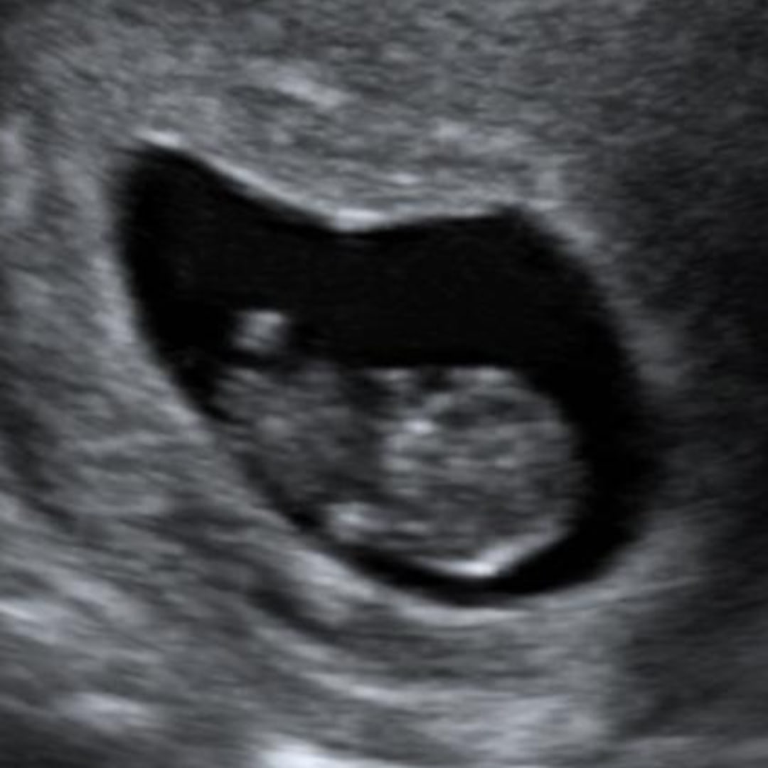 Photo shared by Caitlyn for their Babylist baby registry.