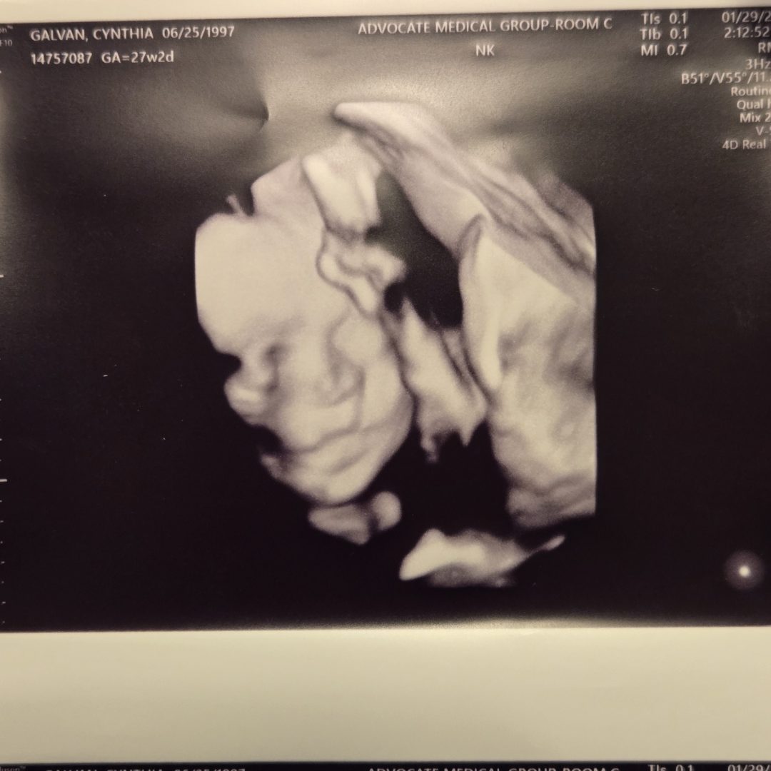 Photo shared by Cynthia for their Babylist baby registry.