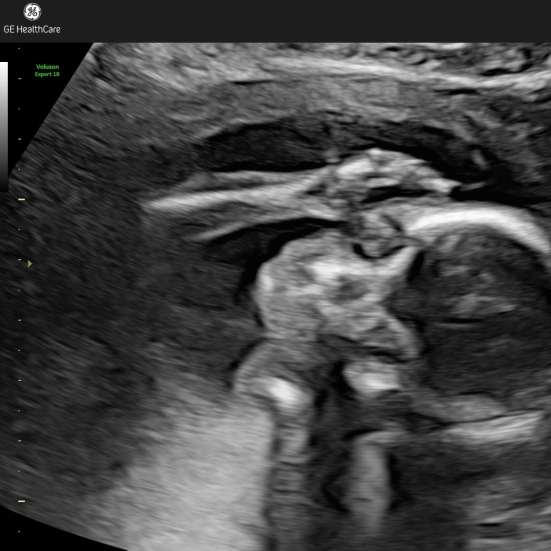 Photo shared by Patsy for their Babylist baby registry.