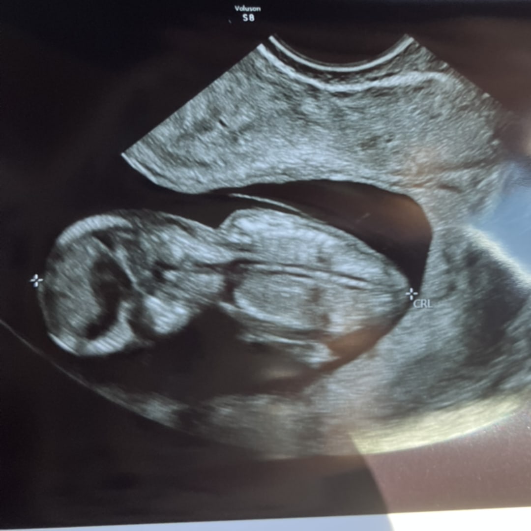 Photo shared by Helen for their Babylist baby registry.