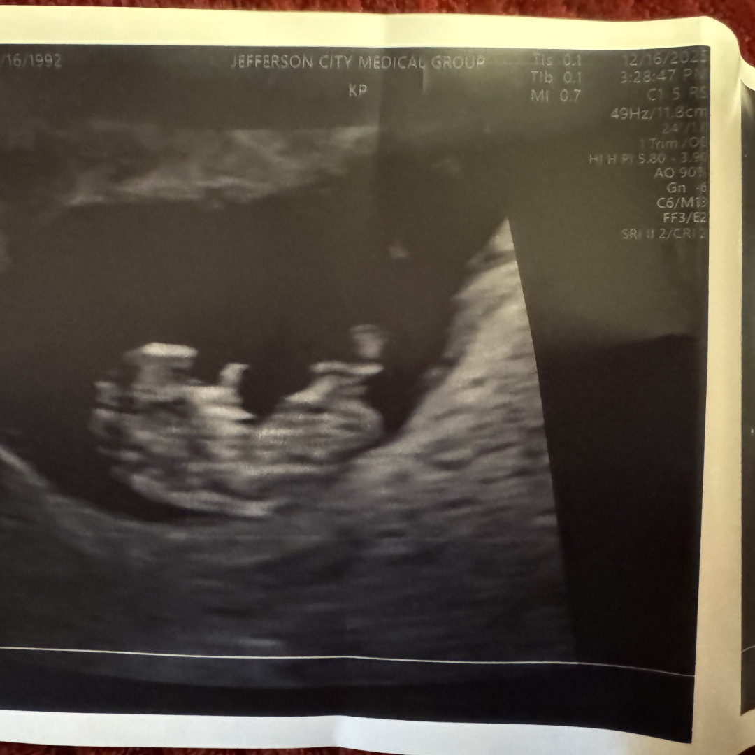 Photo shared by Lindsay for their Babylist baby registry.