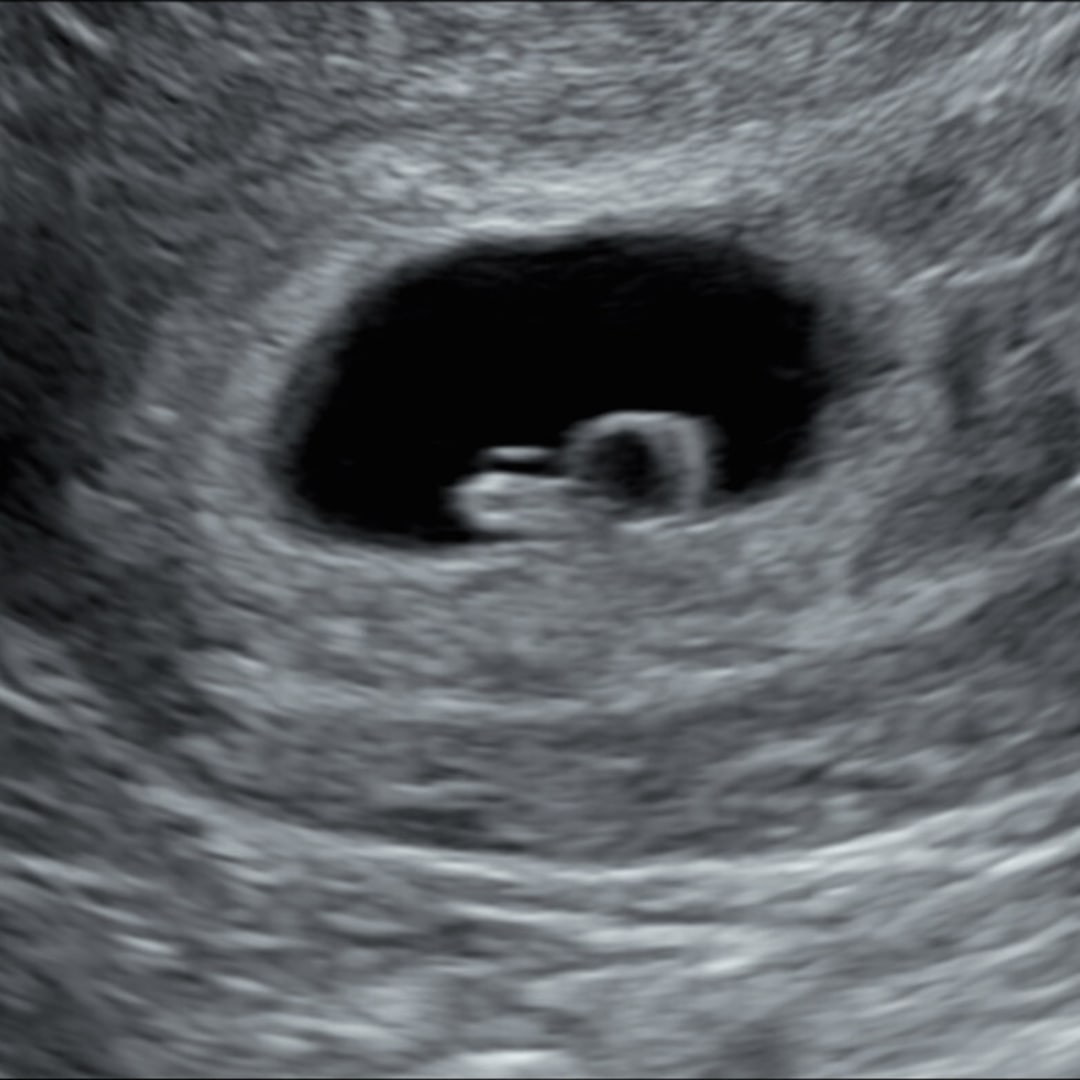 Photo shared by Paisley for their Babylist baby registry.