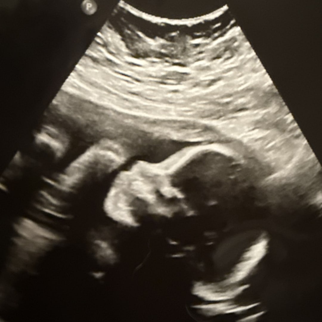Photo shared by Izzy for their Babylist baby registry.