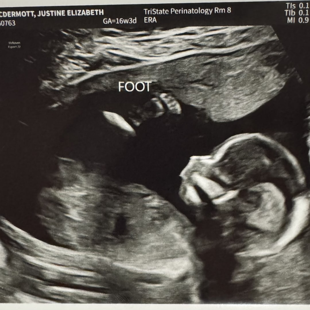 Photo shared by Justine for their Babylist baby registry.