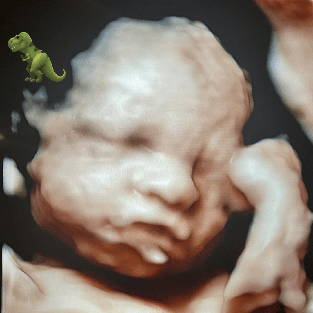 Photo shared by Monique for their Babylist baby registry.
