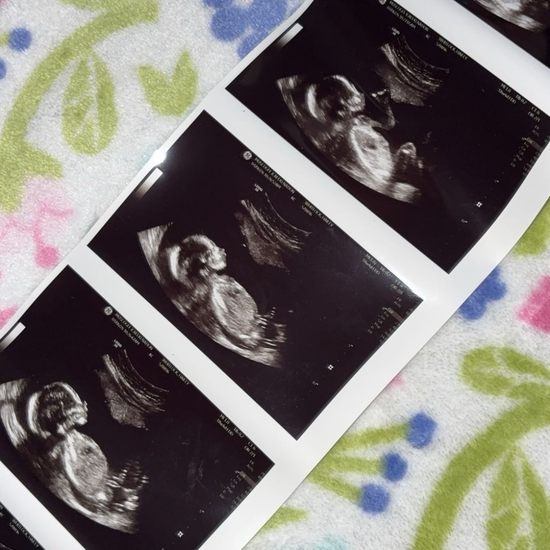 Photo shared by Hailey for their Babylist baby registry.