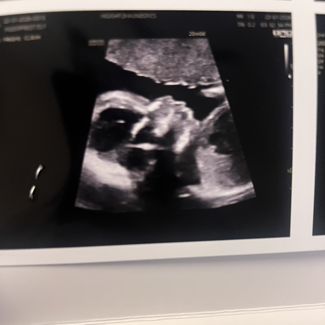 Photo shared by Preeti for their Babylist baby registry.