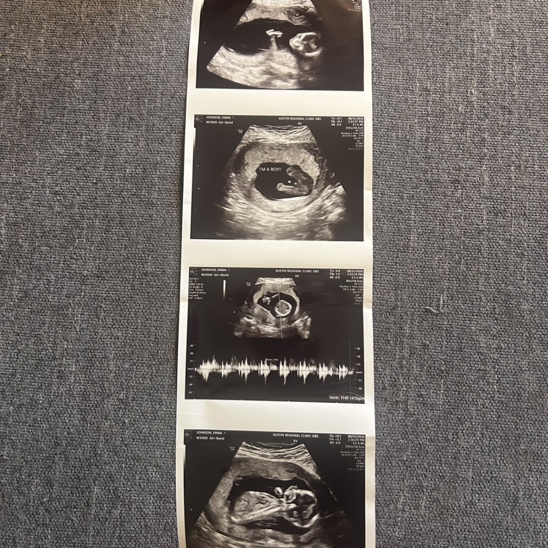 Photo shared by Emma for their Babylist baby registry.