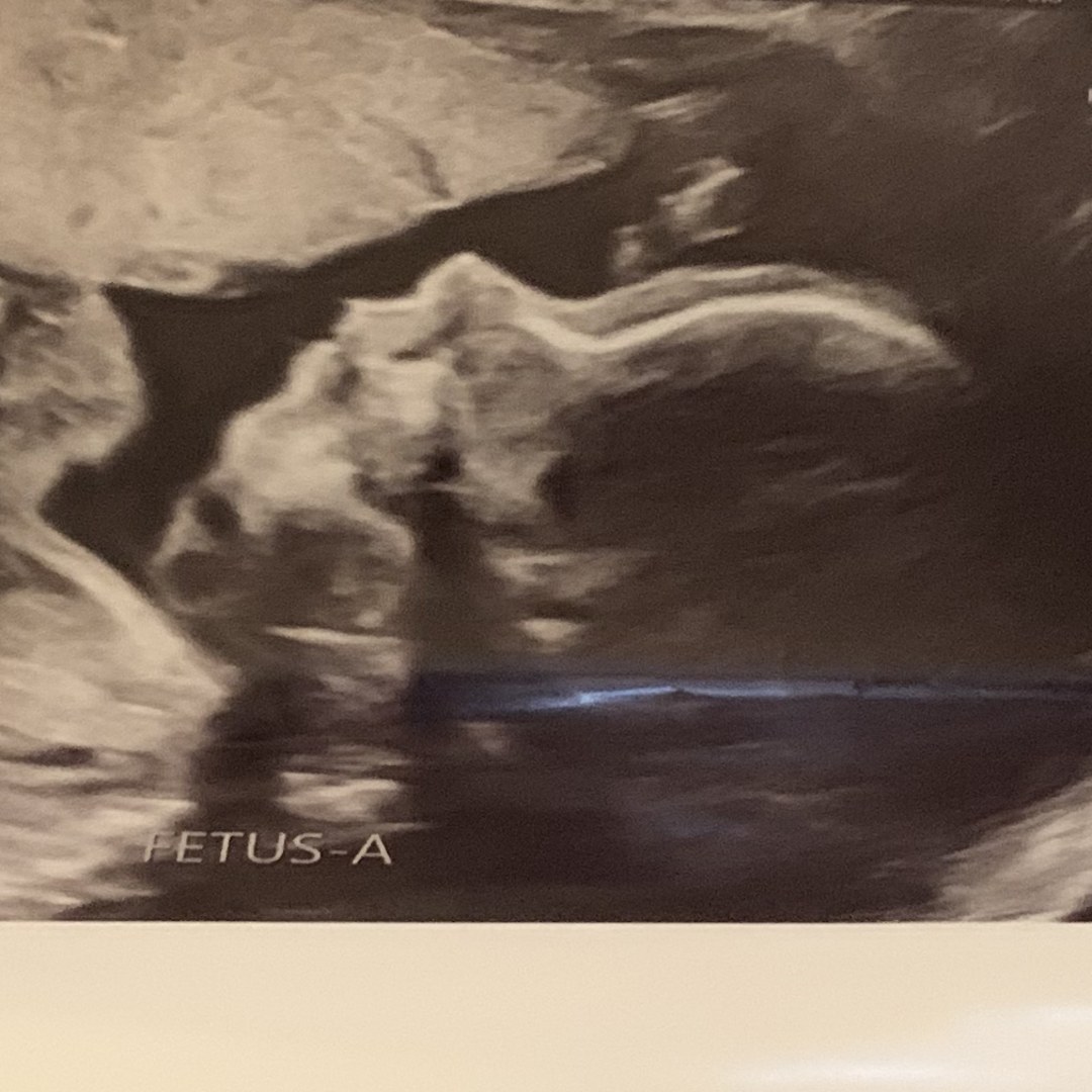 Photo shared by Alivia for their Babylist baby registry.
