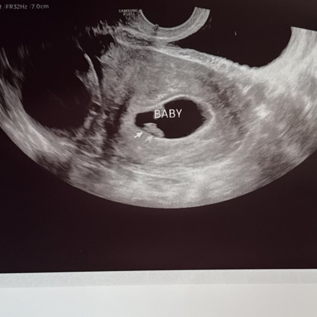 Photo shared by Hannah for their Babylist baby registry.