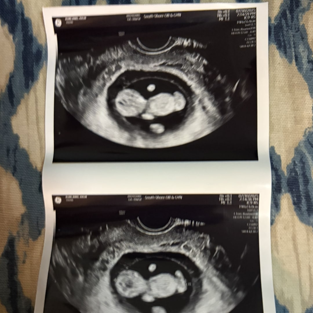 Photo shared by Julia for their Babylist baby registry.