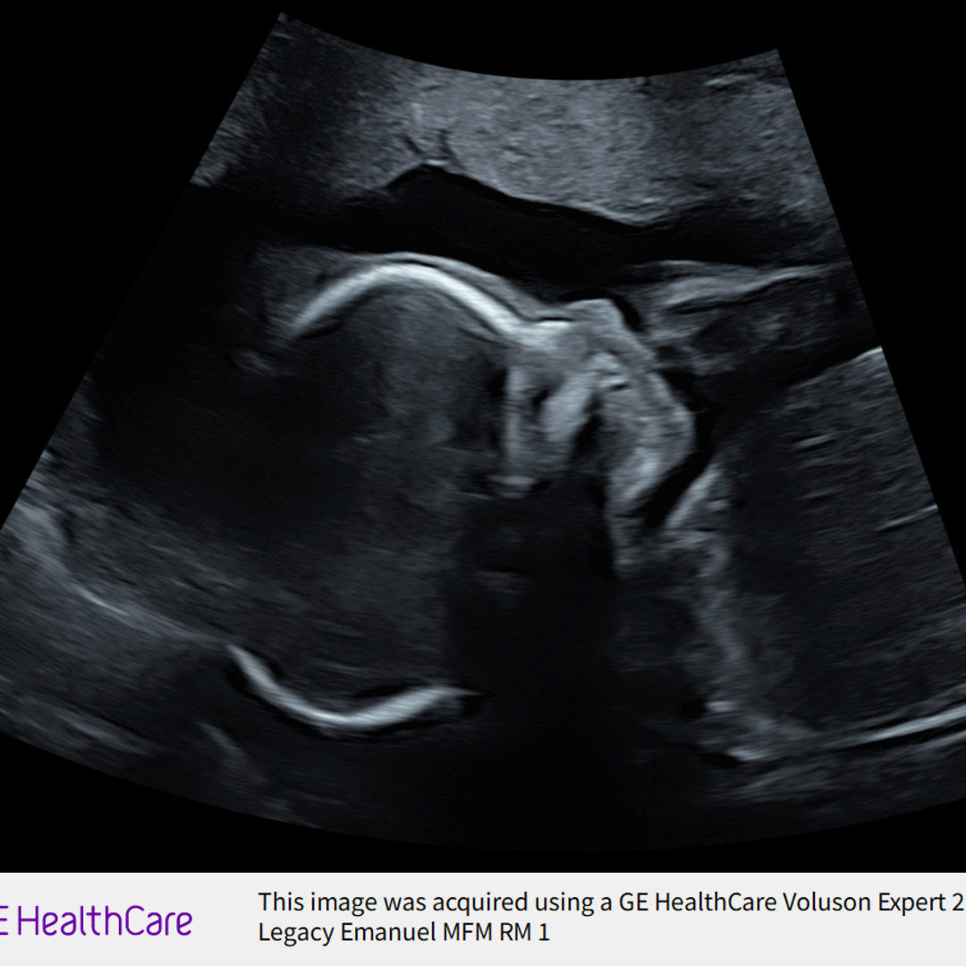 Photo shared by Aylon for their Babylist baby registry.