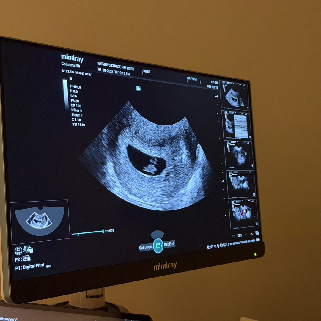 Photo shared by Iryna for their Babylist baby registry.