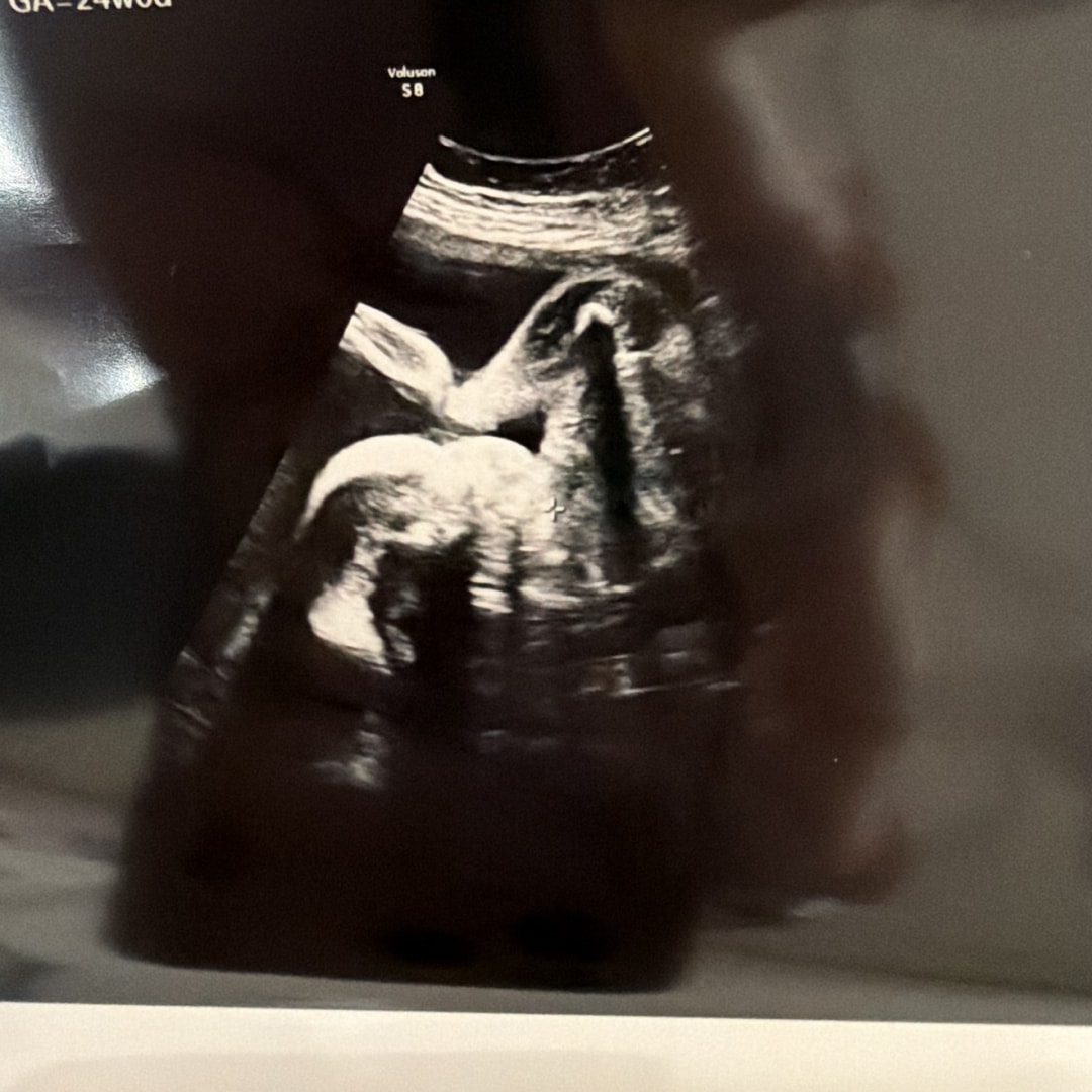 Photo shared by Ellie for their Babylist baby registry.