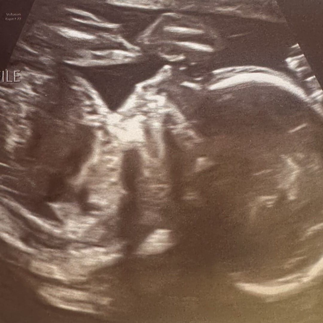 Photo shared by Jaqueline for their Babylist baby registry.