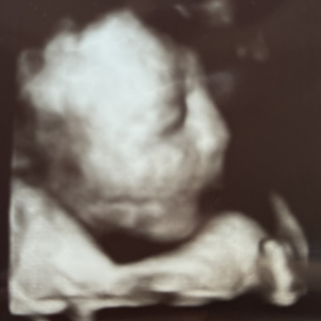 Photo shared by Hannah for their Babylist baby registry.