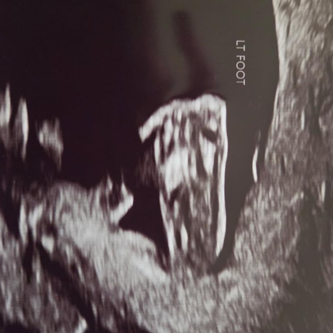 Photo shared by Caitlin for their Babylist baby registry.