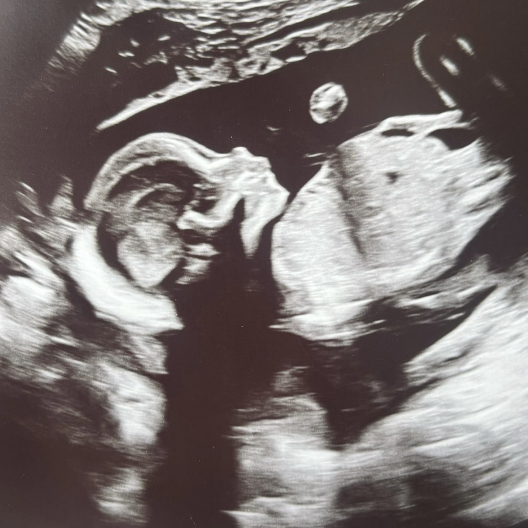 Photo shared by Alexis for their Babylist baby registry.