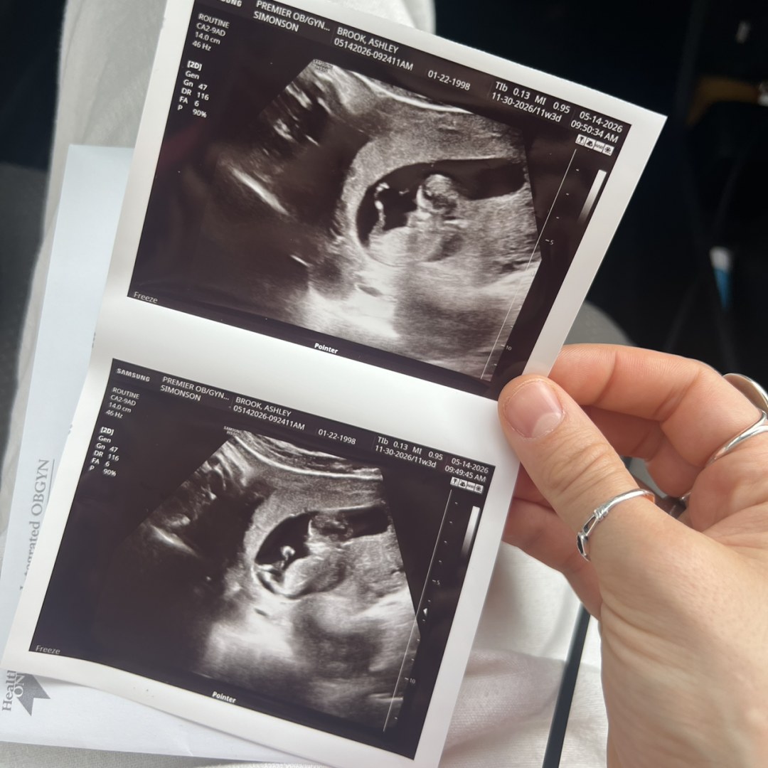 Photo shared by Ashley for their Babylist baby registry.