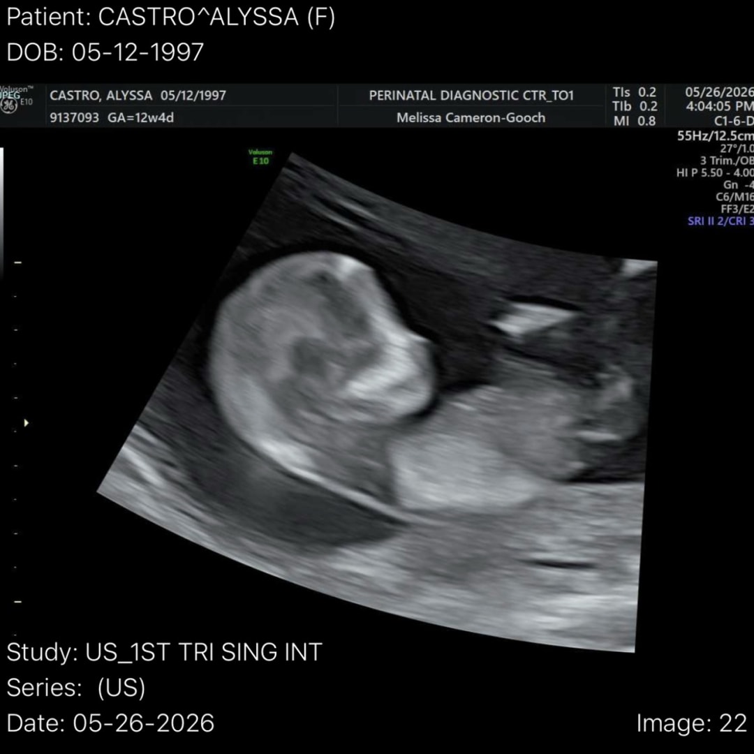Photo shared by Alyssa for their Babylist baby registry.