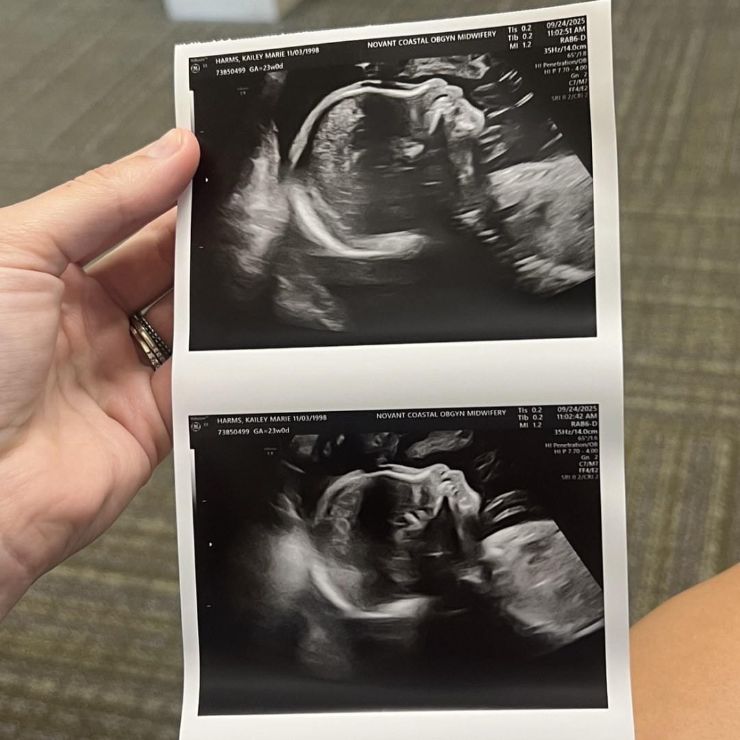 Photo shared by Kailey for their Babylist baby registry.