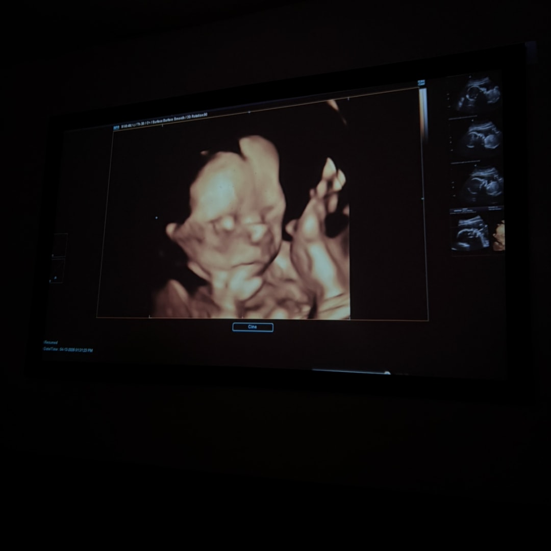 Photo shared by Araceli for their Babylist baby registry.